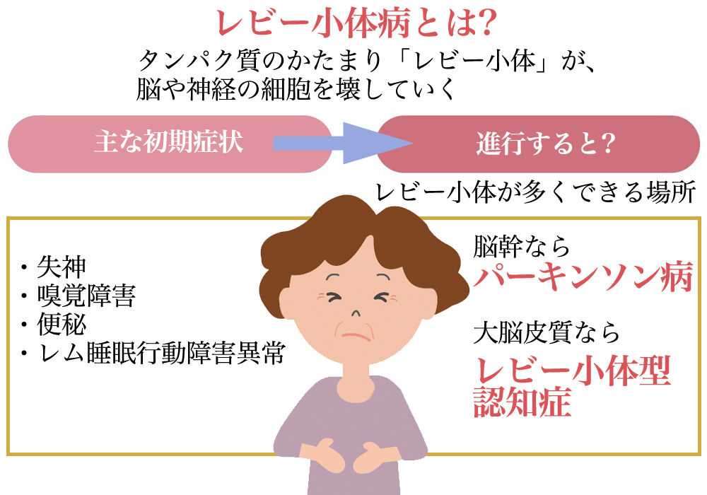 レビー小体型認知症 Dlb 医療法人津樹会 城東病院